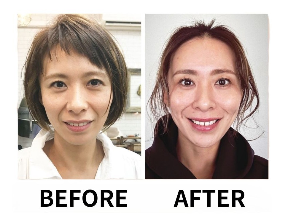 �u���֘A�摜�F4������W�@���琶�������I�\��؃��K�@���������聄